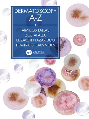 cover image of Dermatoscopy A-Z